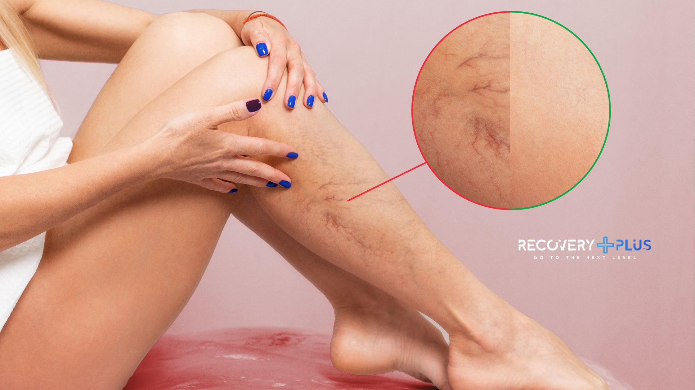 Presoterapia varices